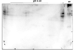 2D SDS-PAGE and WB of PARP1 OVCAR-8 Wild Type Lysate was separated on 2D SDS-PAGE and blotted on PVDF to analyze immunocoverage of PARP1 antibody specific for the zinc finger 1 domain of PARP1.