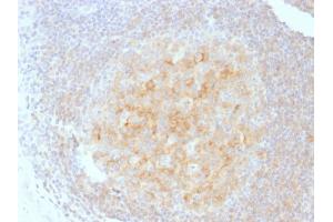 Formalin-fixed, paraffin-embedded human Tonsil stained with CD40 Mouse Monoclonal Antibody (C40/1605).