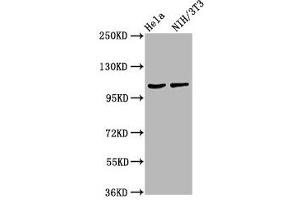 Western Blot Positive WB detected in: Hela whole cell lysate, NIH/3T3 whole cell lysate All lanes: MKL2 antibody at 4. (MKL2 anticorps  (AA 164-313))