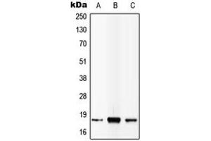 Western blot analysis of IL-4 expression in MCF7 (A), SP2/0 (B), PC12 (C) whole cell lysates. (IL-4 anticorps  (C-Term))