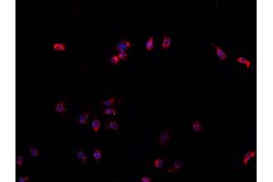 ABIN6266561 staining U-2 OS cells by IF/ICC. (HDAC9 anticorps  (C-Term))