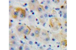 IHC-P analysis of Liver tissue, with DAB staining. (CD97 anticorps  (AA 32-173))