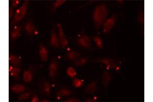 Immunofluorescence (IF) image for anti-Propionyl CoA Carboxylase beta Polypeptide (PCCB) antibody (ABIN1876603)