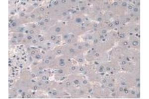 IHC-P analysis of Mouse Liver Tissue, with DAB staining. (Cortactin anticorps  (AA 1-509))