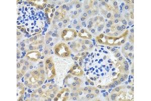 Immunohistochemistry of paraffin-embedded Mouse kidney using DEDD Polyclonal Antibody at dilution of 1:100 (40x lens). (DEDD anticorps)
