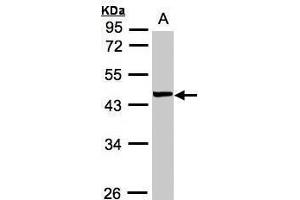 WB Image Sample(30 ug whole cell lysate) A:MOLT4 , 10% SDS PAGE antibody diluted at 1:1000 (VPS72 anticorps)