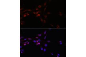 Immunofluorescence analysis of NIH/3T3 cells using SRSF3 antibody (ABIN6132649, ABIN6148465, ABIN6148466 and ABIN6221693) at dilution of 1:100.