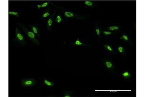 Immunofluorescence of monoclonal antibody to GAN on HeLa cell.