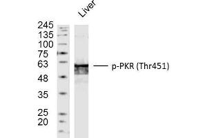 Mouse liver lysates probed with PKR(Thr451) Polyclonal Antibody, unconjugated  at 1:300 overnight at 4°C followed by a conjugated secondary antibody at 1:10000 for 90 minutes at 37°C. (EIF2AK2 anticorps  (pThr451))