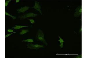 Immunofluorescence of monoclonal antibody to HHEX on HeLa cell. (HHEX anticorps  (AA 133-237))