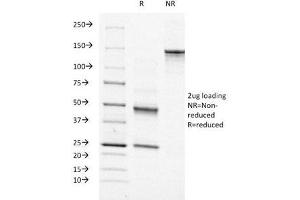 SDS-PAGE Analysis of Purified, BSA-Free Moesin Antibody (clone MSN/491). (Moesin anticorps)