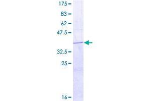 Image no. 1 for Histamine Receptor H4 (HRH4) (AA 194-304) protein (GST tag) (ABIN1307072)