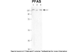Sample Type: 1. (PFAS anticorps  (N-Term))