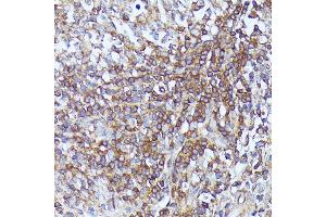 Immunohistochemistry of paraffin-embedded human appendix using Septin 1 antibody (ABIN7270202) at dilution of 1:100 (40x lens). (Septin 1 anticorps  (AA 270-370))