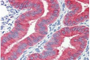 Human Uterus (formalin-fixed, paraffin-embedded) stained with CYCS antibody ABIN462359 followed by biotinylated anti-mouse IgG secondary antibody ABIN481714, alkaline phosphatase-streptavidin and chromogen.