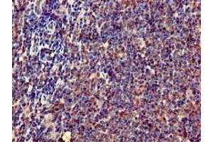 Immunohistochemistry of paraffin-embedded human lymph node tissue using ABIN7169238 at dilution of 1:100 (ERN1 anticorps  (AA 493-561))