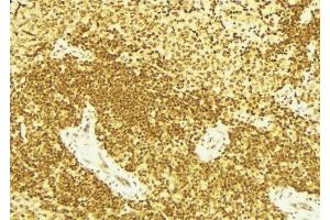 ABIN6267689 at 1/100 staining Mouse spleen tissue by IHC-P.