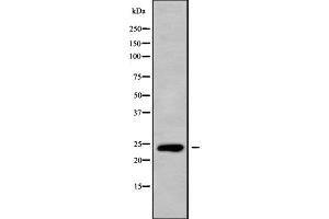 Western blot analysis of CLEC6A using HepG2 whole cell lysates (C-Type Lectin Domain Family 6, Member A (CLEC6A) (Internal Region) anticorps)