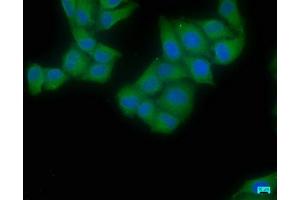 Immunofluorescence staining of Hela cells with ABIN7152176 at 1:50, counter-stained with DAPI. (EIF4G2 anticorps  (AA 706-907))