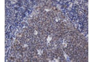 Image no. 1 for anti-Adrenocortical Dysplasia Homolog (ACD) antibody (ABIN1496406)