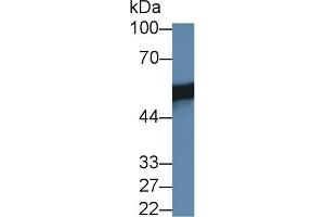 Detection of PSR in Human HepG2 cell lysate using Polyclonal Antibody to Phosphatidylserine Receptor (PSR)