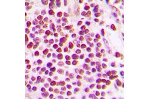 Immunohistochemical analysis of Cullin 2 staining in human tonsil formalin fixed paraffin embedded tissue section.
