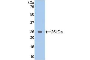 Western blot analysis of recombinant Human PSA. (NPEPPS anticorps  (AA 584-793))