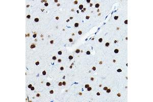 Immunohistochemistry of paraffin-embedded rat brain using FOSL1 Rabbit pAb (ABIN6131653, ABIN6140738, ABIN6140739 and ABIN6221016) at dilution of 1:100 (40x lens).