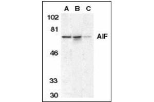 Western blot analysis of AIF in K562 cell lysate (A), mouse (B), and rat (C) liver tissue lysates with AIF antibody at 1 µg/ml. (AIF anticorps  (AA 593-606))