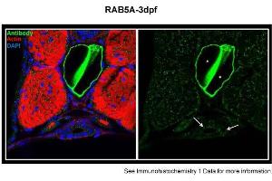 Sample type: zebra gut epithelial cellsGreen: primaryRed: actinBlue: DAPIPrimary dilution: 1:5000Secondary Dilution: 1:300Image Submitted by: Michel BagnatDuke University Medical Center .