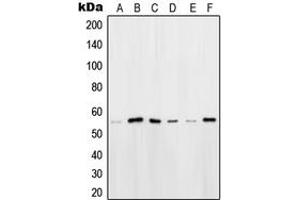 Western blot analysis of OCT2 expression in HeLa (A), HEK293T (B), Ramos (C), K562 (D), Raji (E), NIH3T3 (F) whole cell lysates. (Oct-2 anticorps  (N-Term))