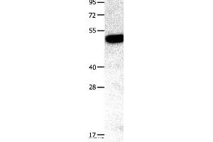 Western blot analysis of Mouse kidney tissue, using TNFRSF11B Polyclonal Antibody at dilution of 1:400 (Osteoprotegerin anticorps)