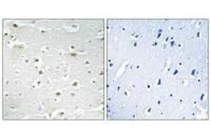 Immunohistochemistry analysis of paraffin-embedded human brain tissue using DDX3Y antibody. (DDX3Y anticorps)