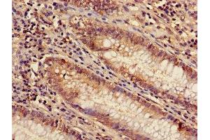 Immunohistochemistry of paraffin-embedded human colon tissue using ABIN7143509 at dilution of 1:100 (ARL4D anticorps  (AA 2-201))