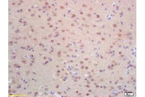 Formalin-fixed and paraffin embedded rat brain labeled with Rabbit Anti Histone H3-like protein Polyclonal Antibody, Unconjugated (ABIN670986) at 1:200 followed by conjugation to the secondary antibody and DAB staining (Centromeric Histone H3-Like Protein-2 (AA 51-145) anticorps)