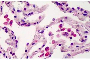 Human Lung: Formalin-Fixed, Paraffin-Embedded (FFPE) (TMEM123 anticorps  (AA 173-188))