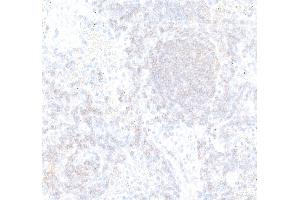 Immunohistochemistry (IHC) image for anti-CD22 Molecule (CD22) (AA 750-800) antibody (ABIN7795736) (Recombinant CD22 anticorps  (AA 750-800))