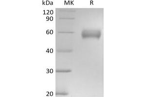 Western Blotting (WB) image for Basigin (Ok Blood Group) (BSG) protein (mFc Tag) (ABIN7319917) (CD147 Protein (mFc Tag))