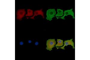 ABIN7095689 and ABIN7099751 staining HepG2 cells by IF/ICC.