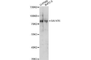 Western blot analysis of extracts of various cell lines, using GALNT6 antibody (ABIN6294086) at 1:1000 dilution. (GALNT6 anticorps)