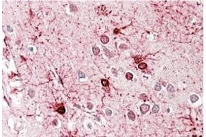 AP23724PU-N (3. (GLUD1 anticorps  (Internal Region))