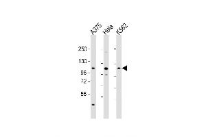 Western Blot at 1:2000 dilution Lane 1: A375 whole cell lysate Lane 2: Hela whole cell lysate Lane 3: K562 whole cell lysate Lysates/proteins at 20 ug per lane. (IDE anticorps  (AA 406-435))