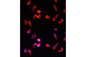 Immunofluorescence analysis of HeLa cells using CG Polyclonal Antibody (ABIN1678951, ABIN3017618, ABIN3017619 and ABIN6220165) at dilution of 1:100 (40x lens).