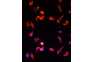Immunofluorescence analysis of HeLa cells using CG Polyclonal Antibody (ABIN1678951, ABIN3017618, ABIN3017619 and ABIN6220165) at dilution of 1:100 (40x lens). (CAMKII gamma anticorps  (AA 300-410))