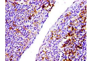 IHC image of ABIN7127278 diluted at 1:100 and staining in paraffin-embedded human tonsil tissue performed on a Leica BondTM system.