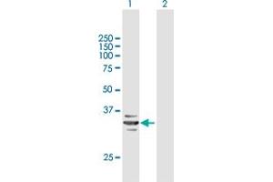Western Blot analysis of RARRES1 expression in transfected 293T cell line by RARRES1 MaxPab polyclonal antibody.