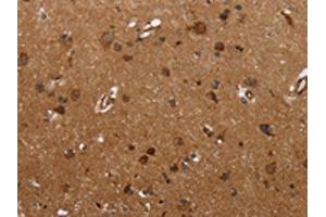 The image on the left is immunohistochemistry of paraffin-embedded Human brain tissue using ABIN7190664(FMN2 Antibody) at dilution 1/30, on the right is treated with synthetic peptide. (Formin 2 anticorps)