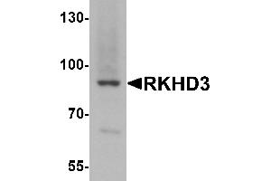Western blot analysis of RKHD3 in mouse skeletal muscle tissue lysate with RKHD3 antibody at 1 µg/mL. (MEX3B anticorps  (Middle Region))