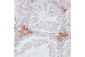 Immunohistochemistry of paraffin-embedded mouse testis using KIFC1 antibody (ABIN1680592, ABIN3017666, ABIN3017667 and ABIN6220203) at dilution of 1:100 (40x lens). (KIFC1 anticorps  (AA 1-250))