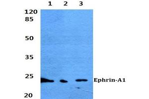Western blot (WB) analyzes of Ephrin-A1 antibody at 1/500 dilution. (Ephrin A1 anticorps)